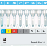 DG Gel ABO/Rh (2D)