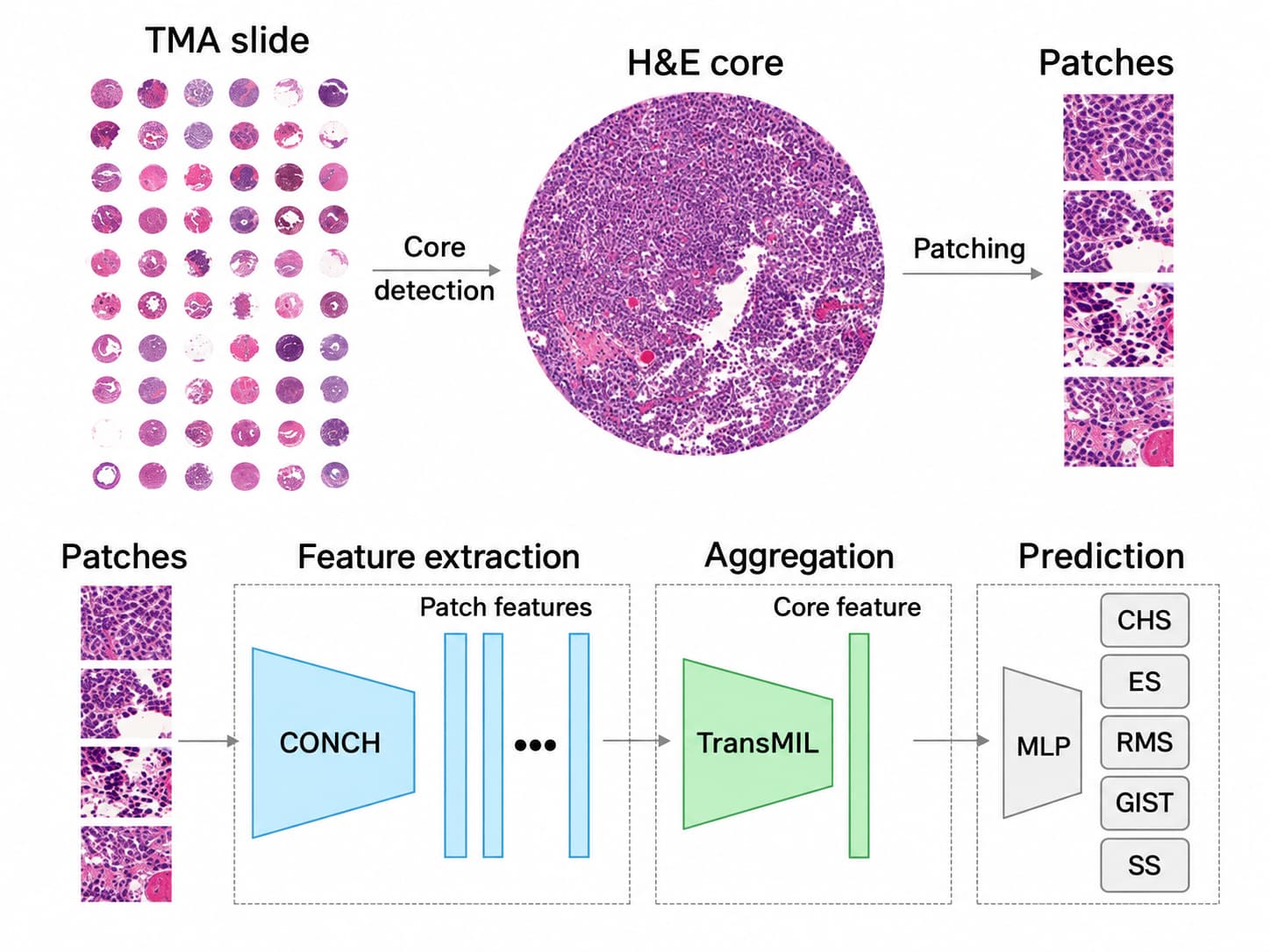 Pathology workflow from cores to prediction